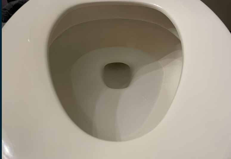 Leaky Toilet Leads to $3,100 Sewer Line Repair